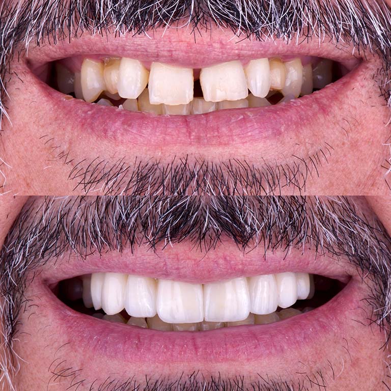 clínica dental en Monterrey